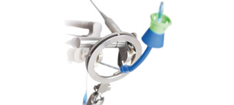 Endocontrol : Déploiement international